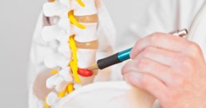 Herniated Disc Chiropractor Treatment In Troy, Michigan