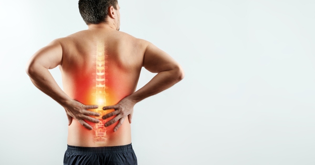 Back Pain due to Sciatica